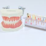歯列矯正の中でもインビザライン矯正とはどんな矯正方法なのなのでしょうか？