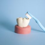 歯列矯正中の歯磨きの仕方について。どうすれば早く効率的に磨けるのでしょうか？